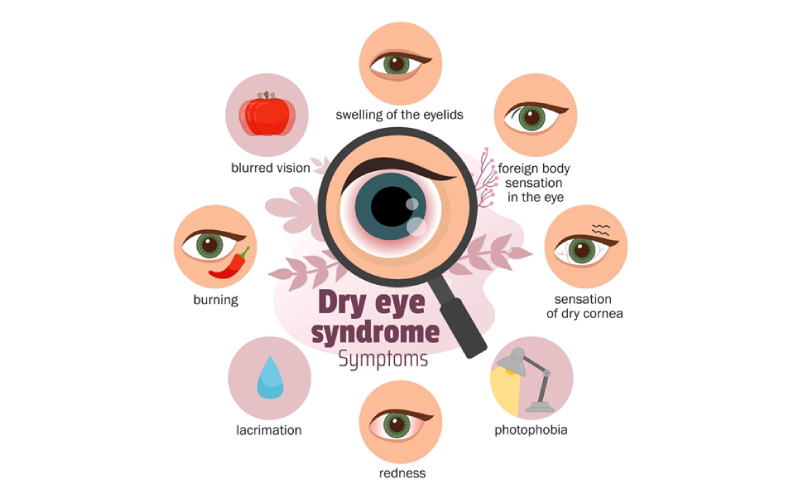 Dry Eye Syndrome